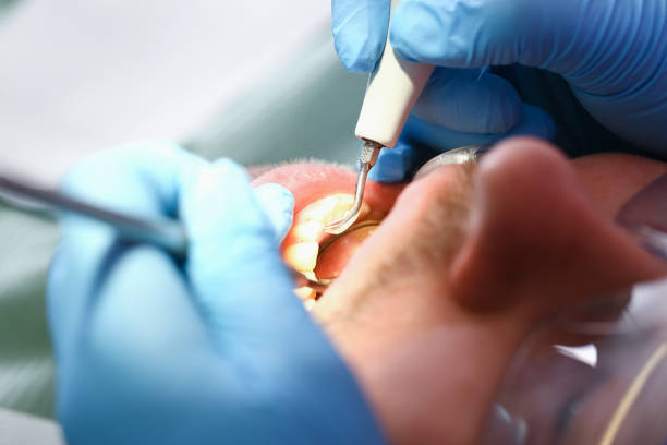 Best Broken or Chipped Tooth Repair in Day Heights, OH